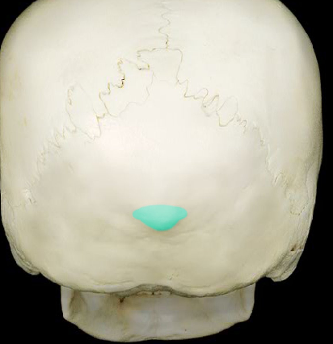 <p>Attachment for Nuchal Ligament</p>