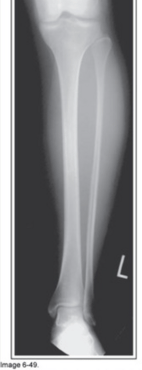 <p>Internally rotated</p>