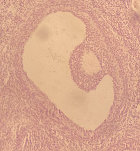 <p>stage of development and maturation</p>