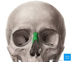 <p>What type of bone is this </p>