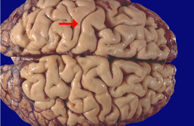 <p>Label this brain structure</p>