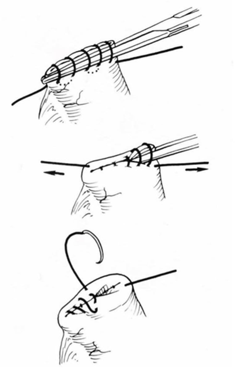 <p>What is demonstrated here?</p>