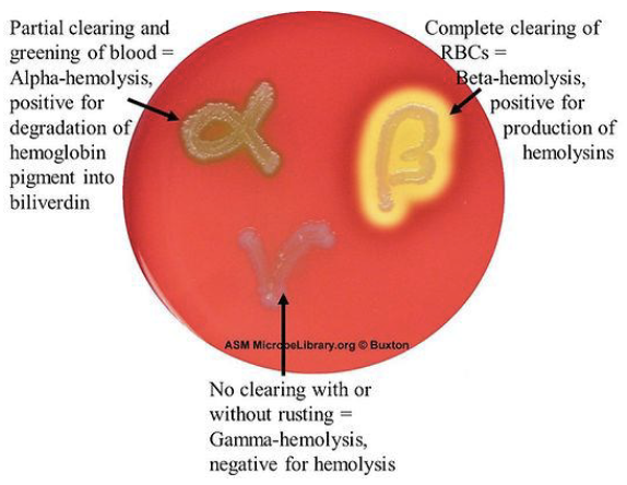 <p>Hemolysis</p>