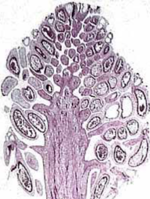 <p>Which structure is being shown?</p>