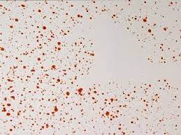 -An absence of a stain in an otherwise continued bloodstain pattern 
-Indicates that a person or object was in the way of the blood spatter and was later moved