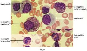 <p>contains large, eosin staining crystalloid granules, granules larger than neutrophils and more of them</p><p>lots of cytoplasm, nucleus usually one lobe, maybe nucleoli, secondary granules</p>