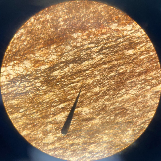 <p>example: brain, spinal cord and nerves<br>function: transmits electrical signals from sensory receptors and to effectors</p>