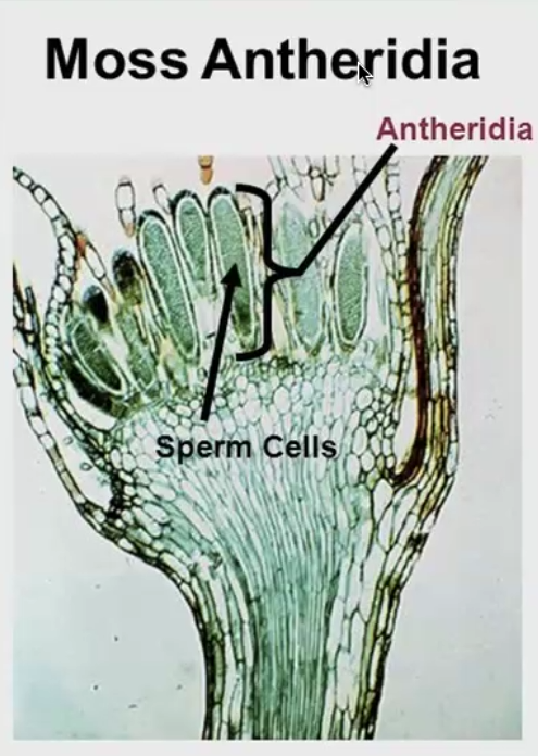 <p>male (flagellated) sperm cells in mosses </p>