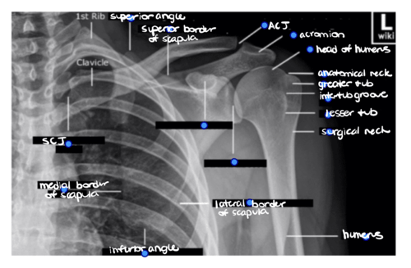 <p>ID the 2 missing structures.</p>