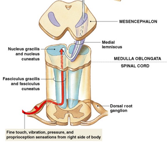 <p>Which major somatic sensory pathway:</p><ul><li><p>Carries sensations of highly localized (“<strong><u>fine</u></strong>”) touch, pressure, vibration, and proprioception</p></li><li><p>Decussation - crossing over</p></li><li><p>Medial lemniscus - tract from medulla to thalamus</p></li></ul><p></p>