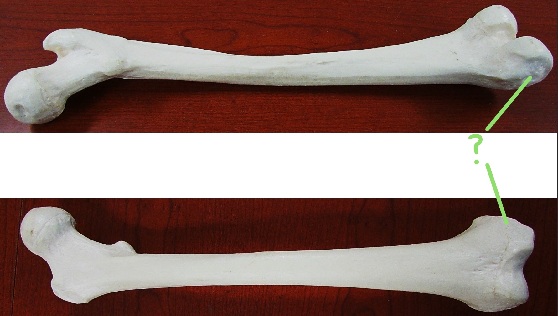 <p>Determine the part of the Femur highlighted</p>