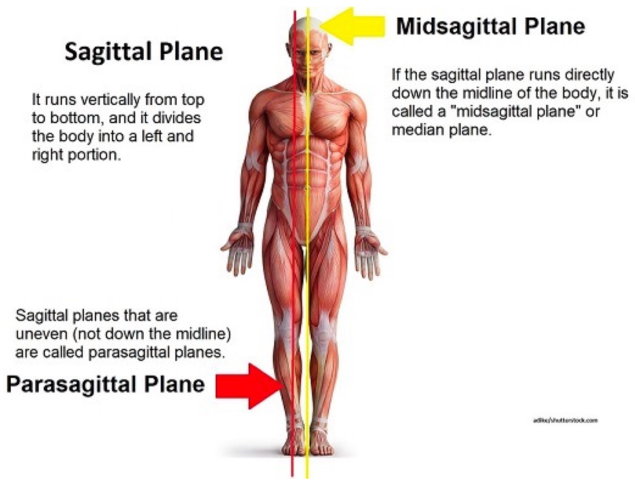 <p><span><strong>Define sagittal and parasagittal planes. Recognize sagittal cuts in an image:</strong></span></p>