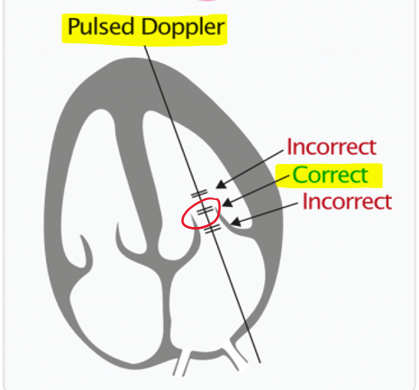 <ul><li><p>apical 4CH</p></li><li><p>PW at opening of mitral valve leaflets </p></li></ul><p></p>