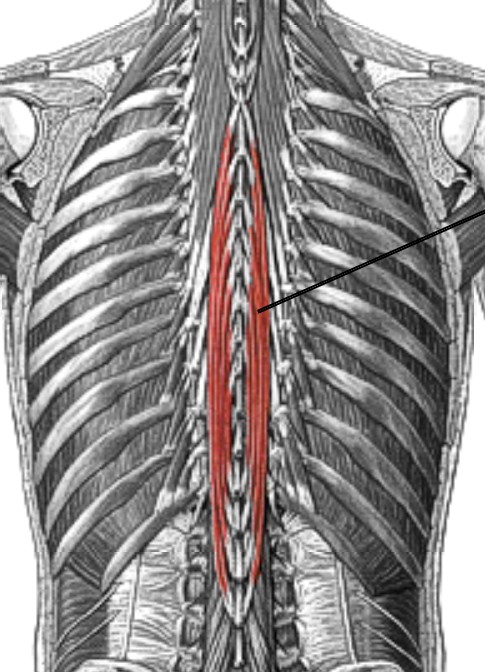 <p>Which muscle of the vertebral column is:</p><ul><li><p>Smallest, most medial</p></li><li><p>Action: bi = spinal ext, uni = lat flex</p></li><li><p>Nerve: <span style="color: yellow;">posterior spinal</span> nerve roots</p></li></ul><p></p>
