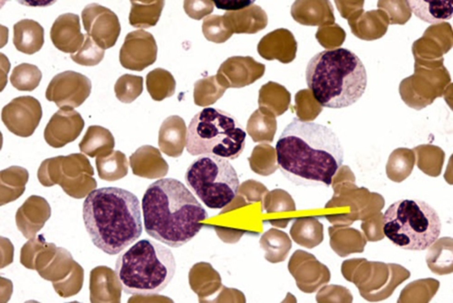 <p>neutral pink in color, with a predominance of secondary and secretory granules.</p>