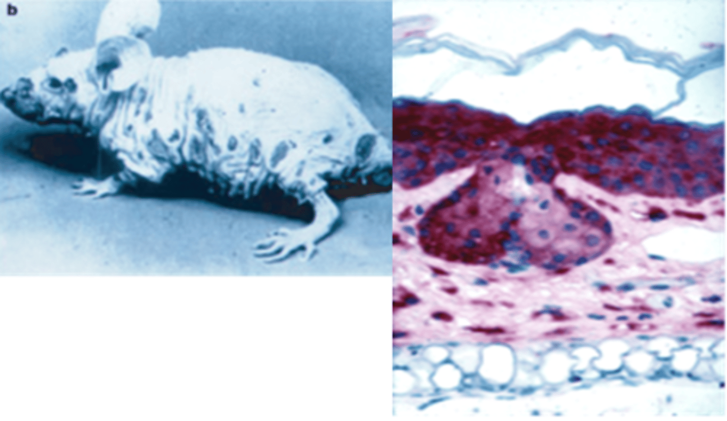 <p>Which two mouse strains are the MOST resistant to the disease depicted?</p><p>a. DBA/2 and C3H</p><p>b. BALB/c and A</p><p>c. C57BL/6 and AKR</p><p>d. SJL and CBA</p>