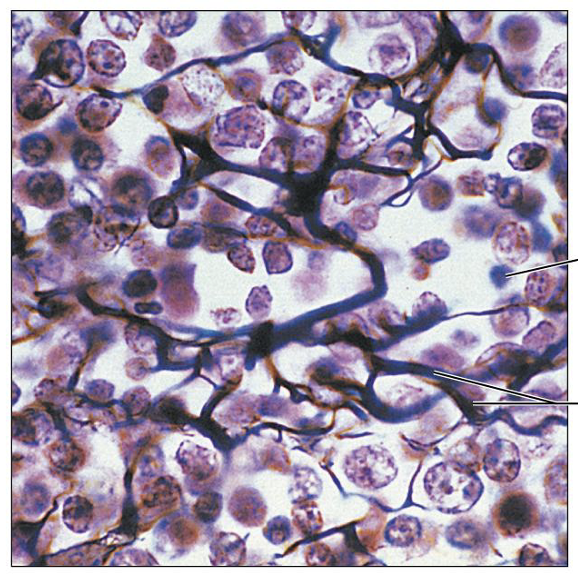 <p>What is this tissue, and where is it found?</p>