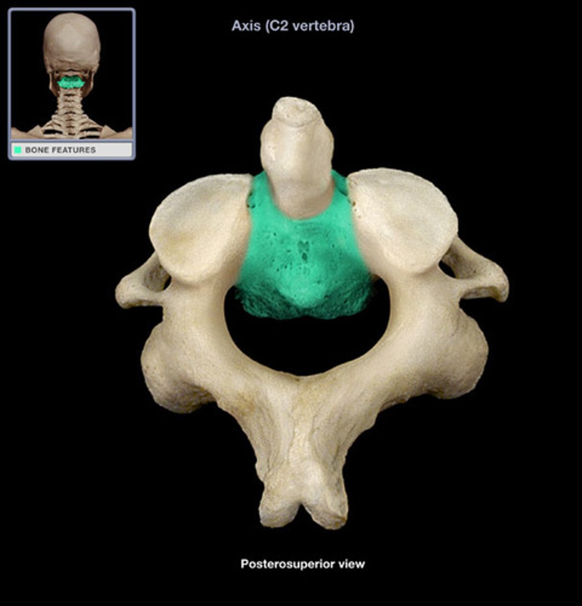 <p>(what vertebra and what structure is highlighted)</p>