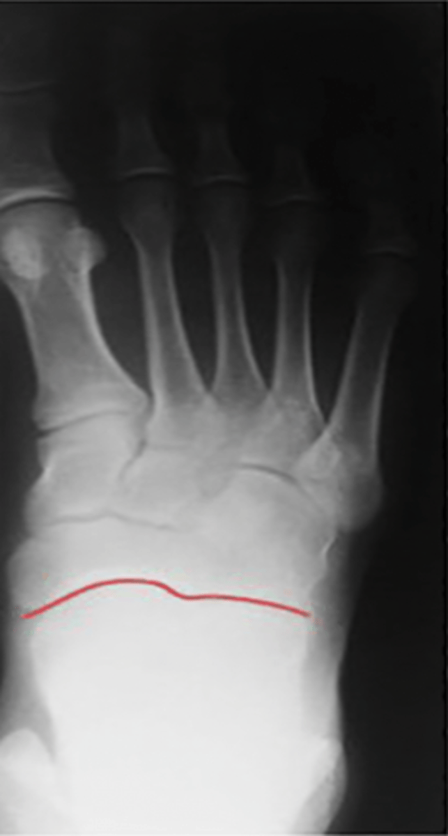 <p>What structure is highlighted?</p>