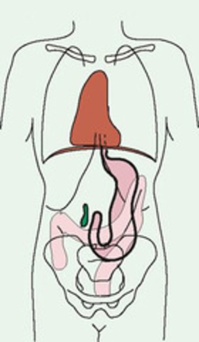 <p>A thin body style, which is more slender than the sthenic body habitus. Approximately 35% of the population is classified this body style.</p>