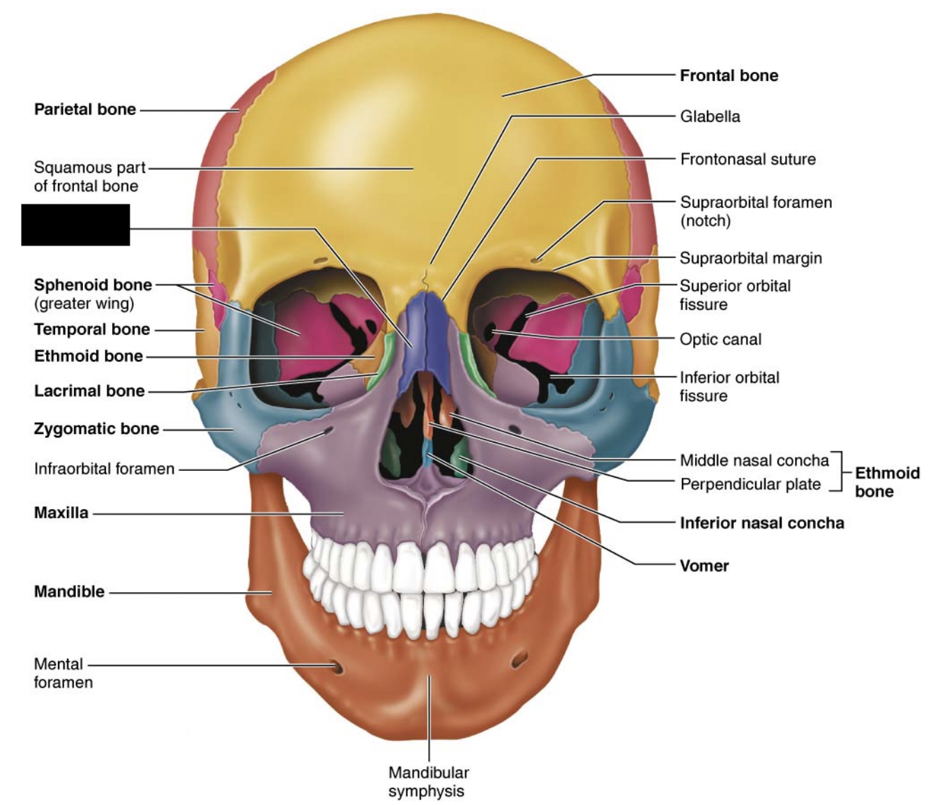 What facial bones is this?