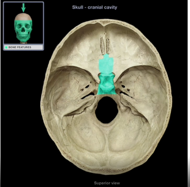 <p>Body of the Sphenoid Bone</p>