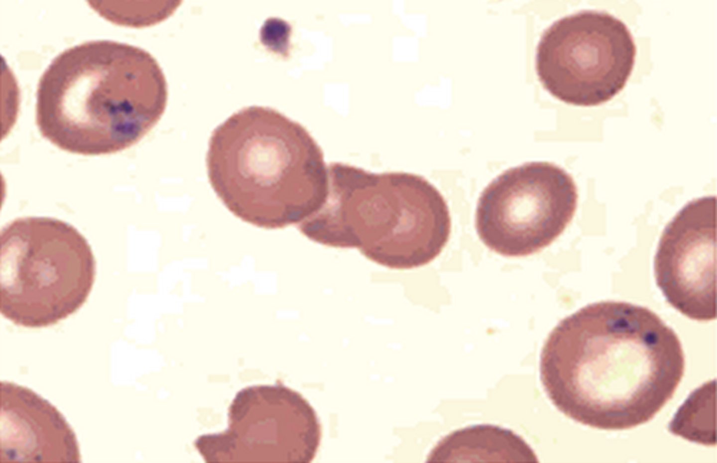 <p>Iron</p><p>seen in sideroblastic anemia, thalassemia</p><p>prussian blue stain</p>