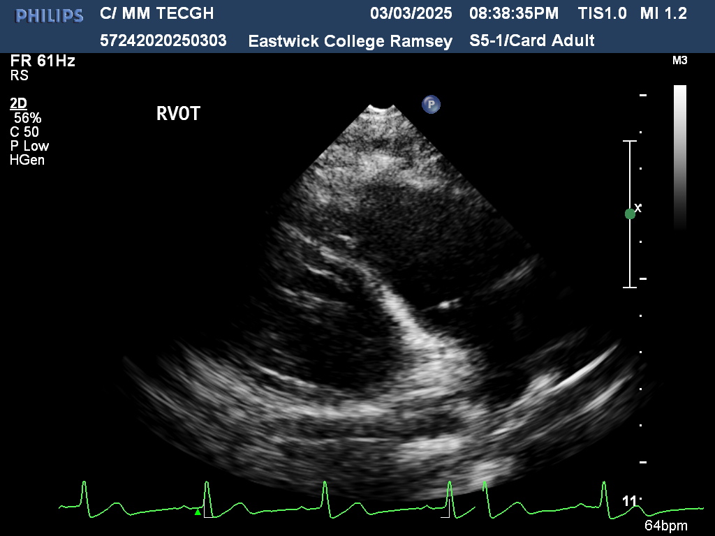 <p>RVOT</p>