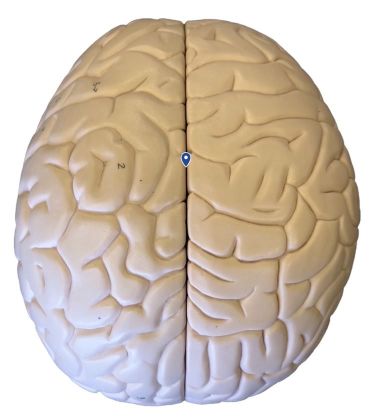 <p>What sulcus is the arrow pointing to?</p>