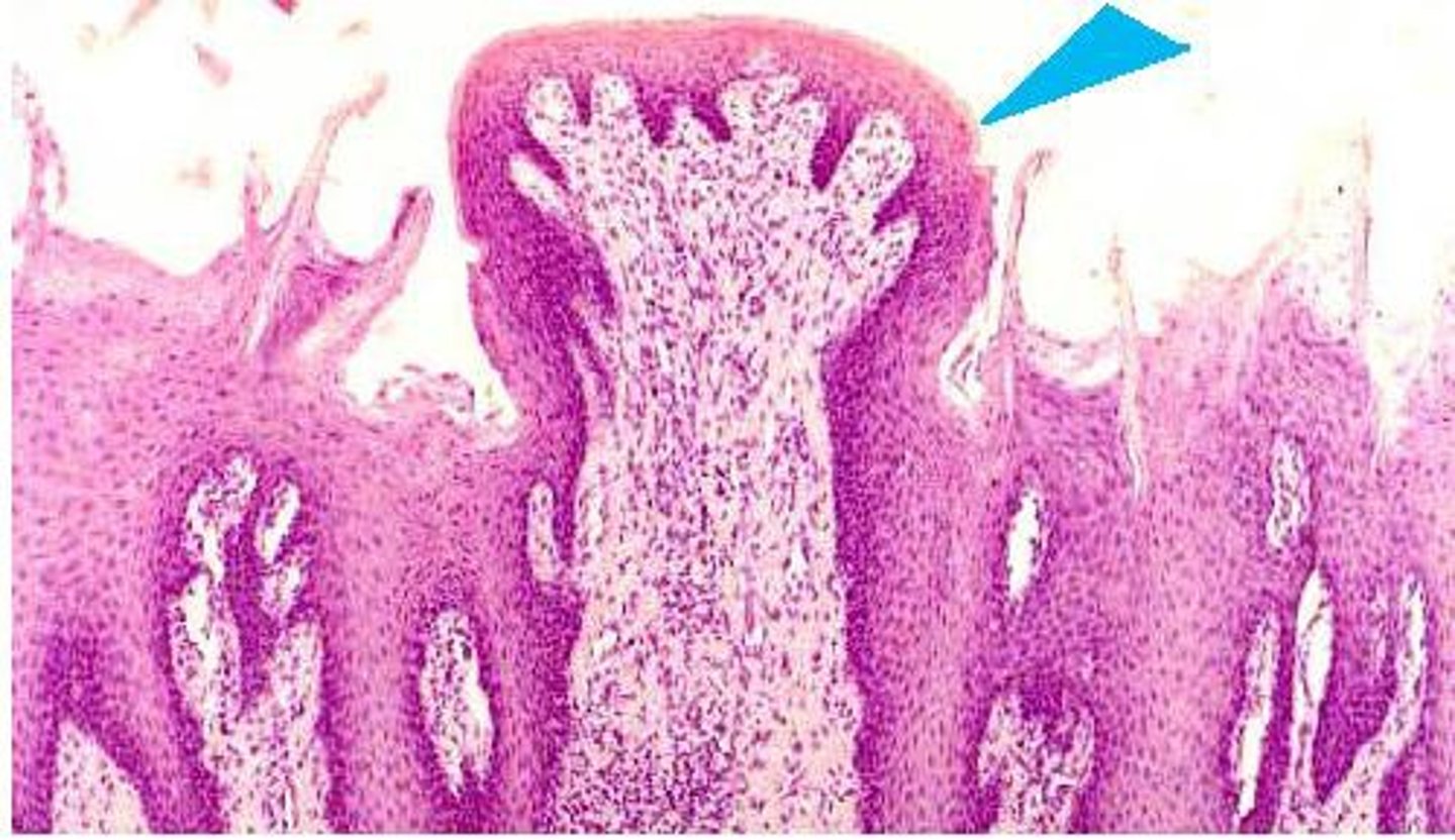 <p>scattered over tongue, concentrated at tips and lateral sides, look like a mushroom</p>