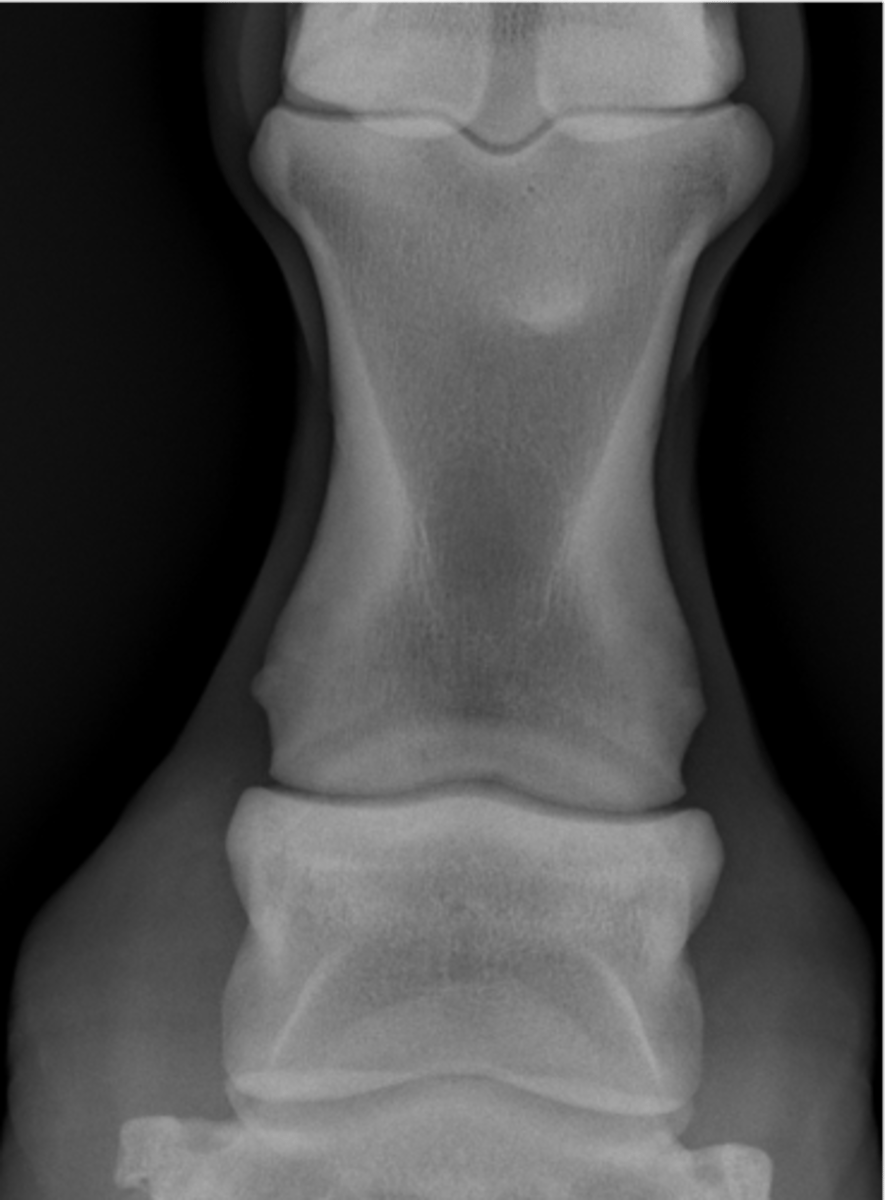 <p>ID joint and view</p>