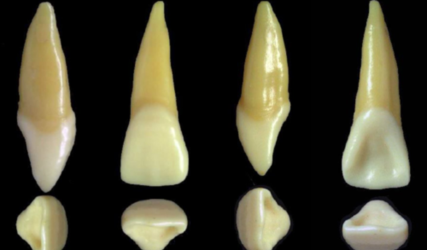<p>what tooth is this &amp; why?</p>