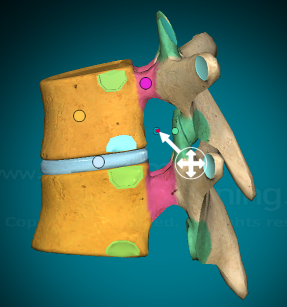 <p>the hole created when inferior facet and superior facets connect</p>