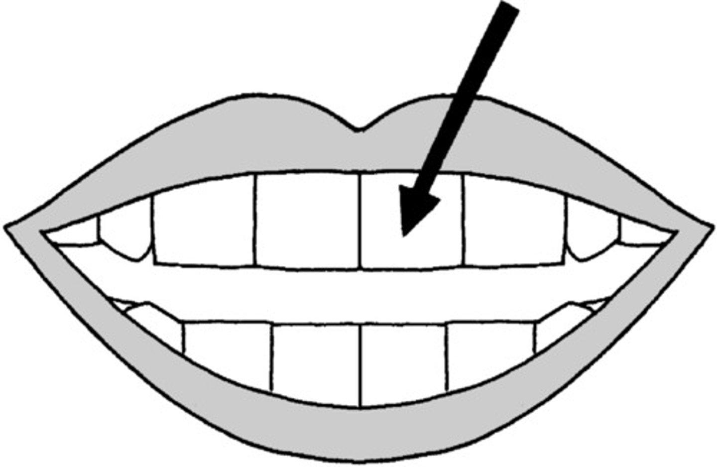 <p>tooth</p>