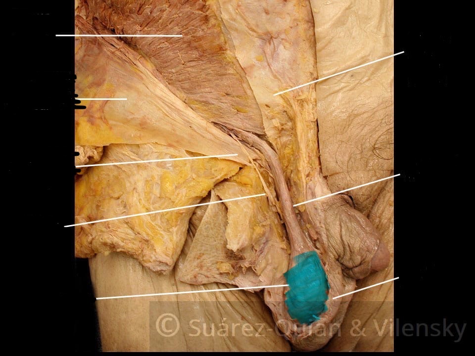 <p>What is the name of this highlighted structure ?</p>