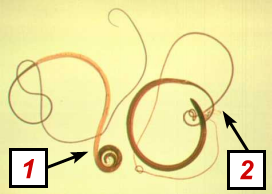 <p>Sobre o(s) parasito(s) na foto, escreva:</p><ul><li><p><strong>NOME CIENTÍFICO</strong></p></li><li><p><strong>FORMA EVOLUTIVA</strong> (+ <strong>SEXO</strong> - <u>se houver</u>)</p></li></ul>