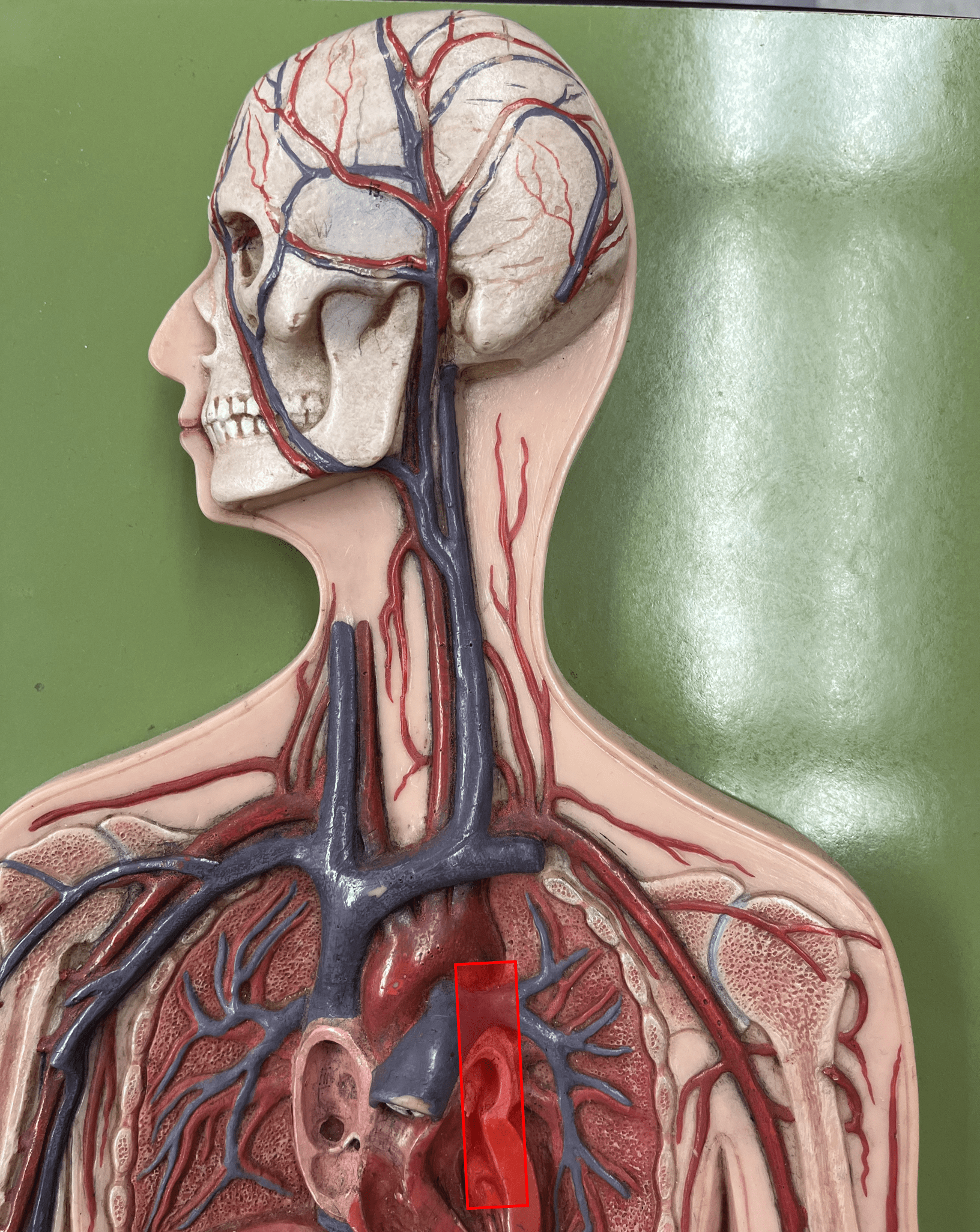 <p>• An artery of the thorax.</p>
<p>• Originates as the continuation of the aortic arch.</p>
<p>• Supplies its branches.</p>