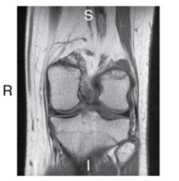 <p style="text-align: left;">What imaging plane is this?</p>