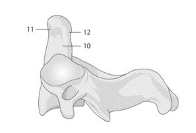 <p>11</p>