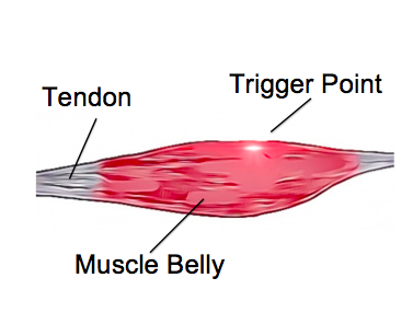 <p>Muscle belly</p>