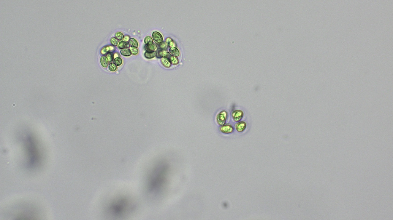 <p>cells held together by secreted gelatinous mixture</p><p>Domain: Bacteria<br>Phylum: Cyanobacteria</p><p>Shape: Coccus</p><p>Movement: non-motile</p><p>Metabolic: Autotrophic</p><p>Form colonies</p>