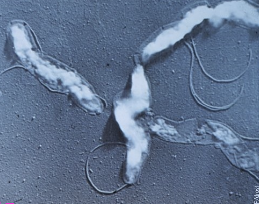 <p>aka genital campylobacteriosis, infection caused by an obligate parasite of the bovine repro tract</p><p>organism: <em>camplylobacter fetus venerealis</em></p><p></p><p><span>motile, gram-negative, curved or spiral, polar flagellated, microaerophilic bacteria</span></p>