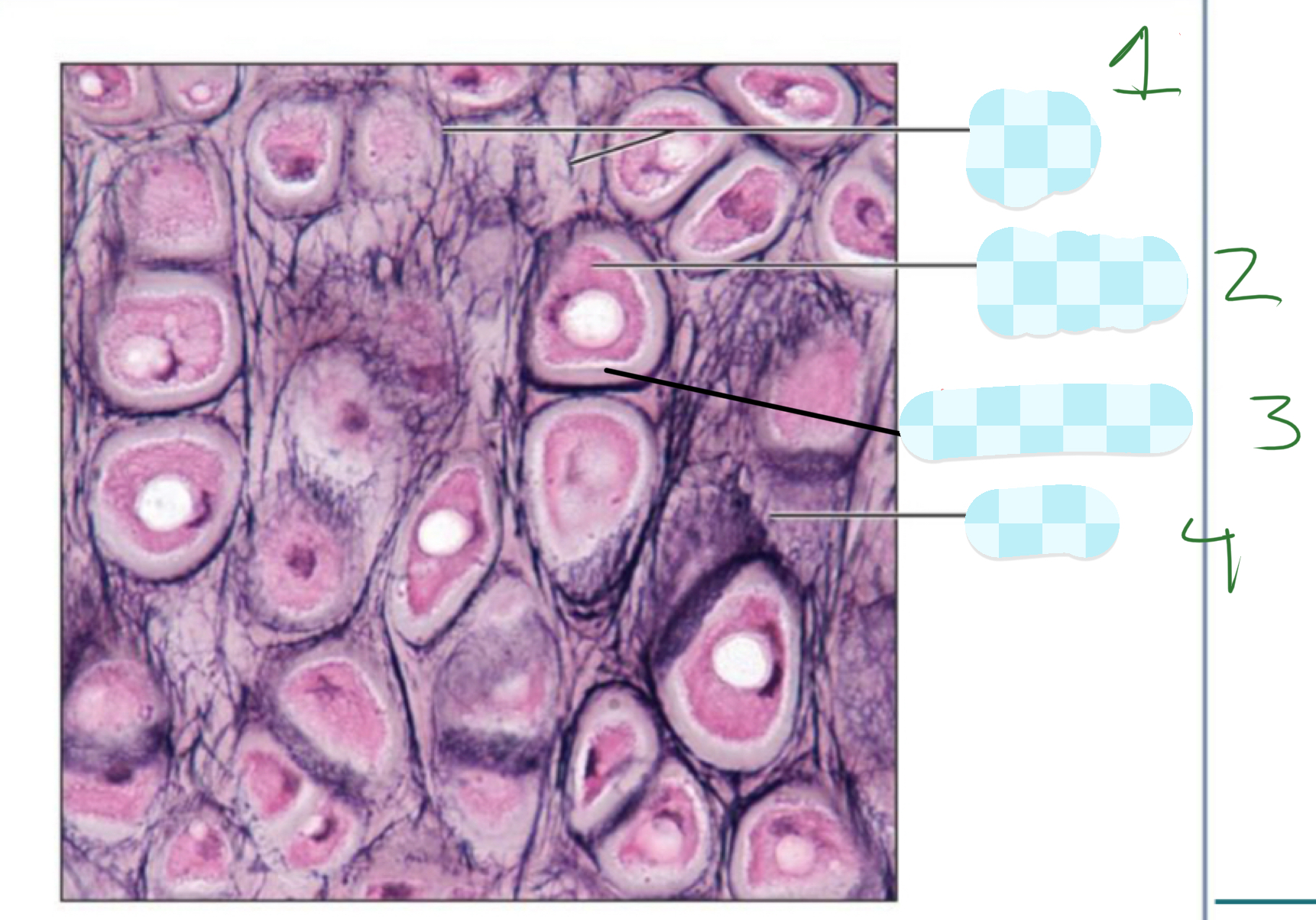 <p>4) elastic cartilage </p>