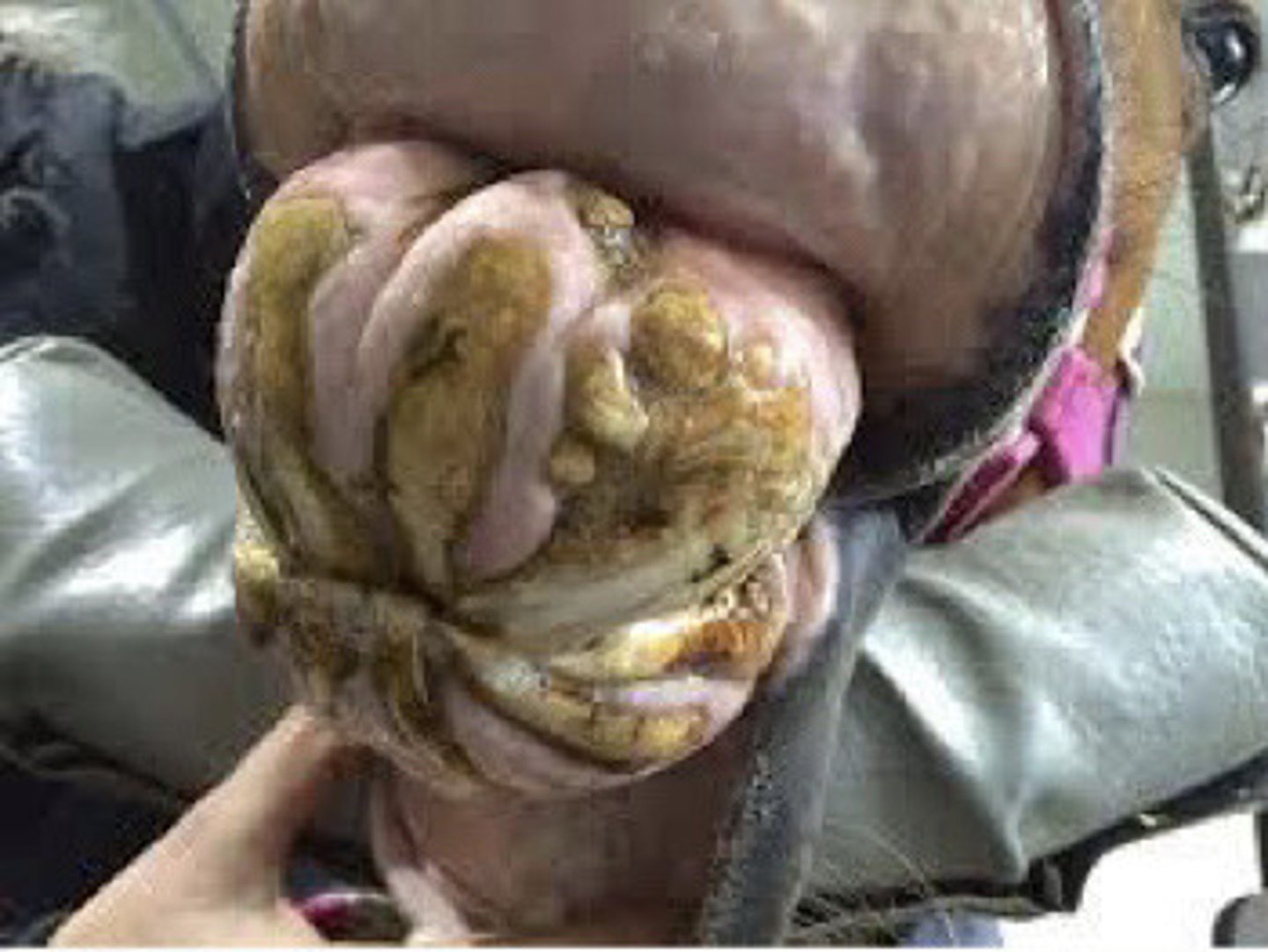 <p>What is the pathology</p>