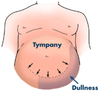 <p>loud high pitch drum like (organ filled with air ex.intestines)</p><p><span data-name="long_drum" data-type="emoji">🪘</span><code><span data-name="drum" data-type="emoji">🥁</span></code></p>