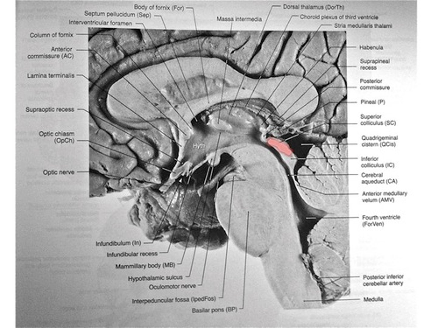 <p>- Deals with Vision Area of Midbrain</p><p>- Eye movement</p><p>- Has nothing to do with what you see. Does not effect the act of seeing things</p>