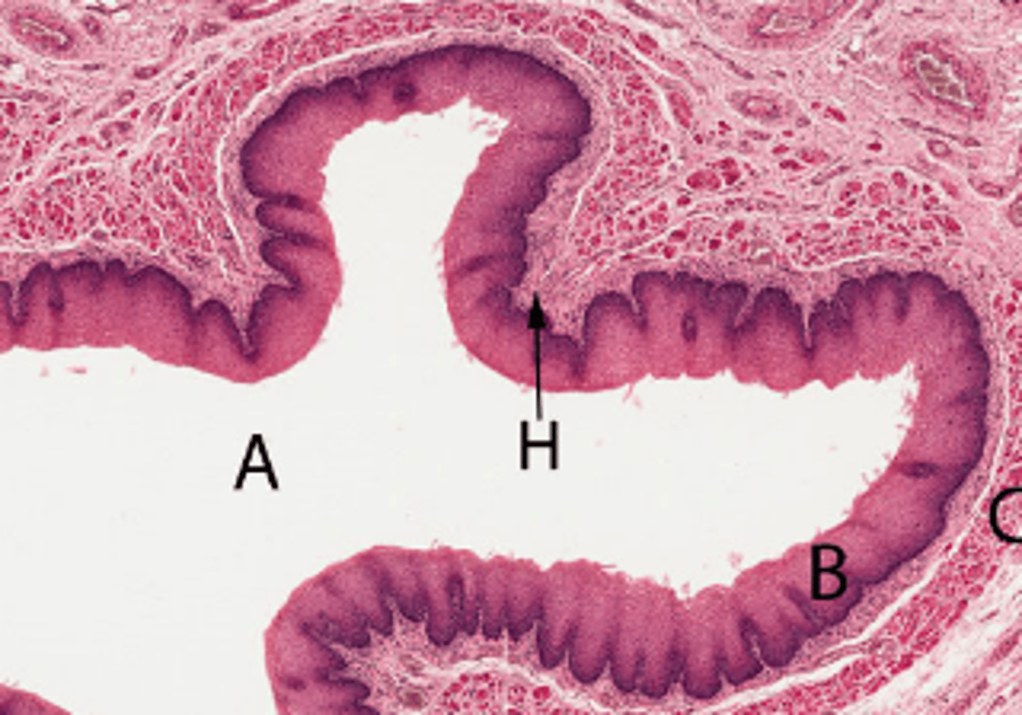 <p>Stratified squamous non-keratinised epithelium</p>