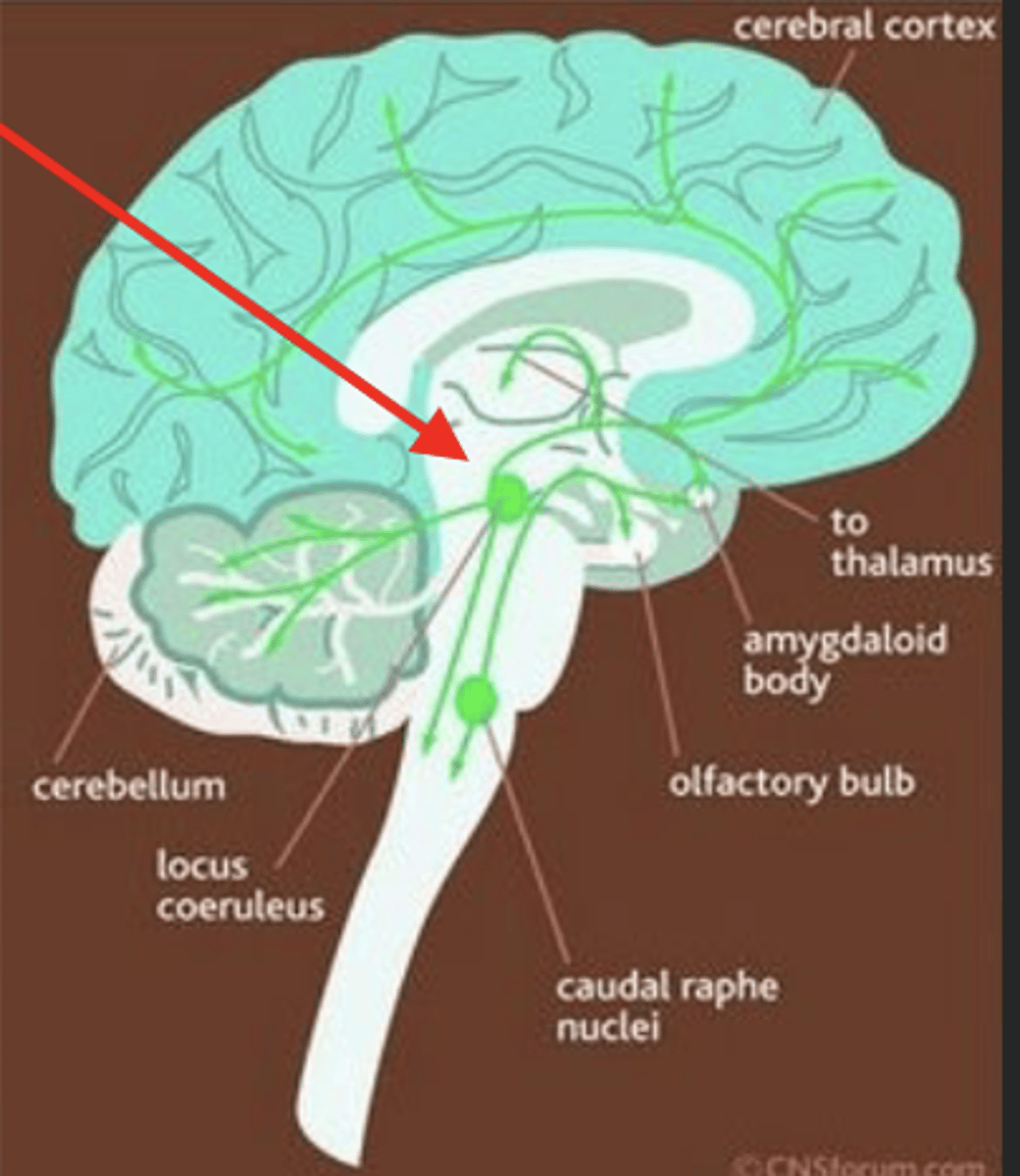 <p>• Overactive noradrenergic system originating in Locus Ceruleus</p><p>• LC projects to Vagus nerve, sympathetic ganglia, hypothalamus,</p><p>thalamus, cortex, cerebellum, amygdala</p>