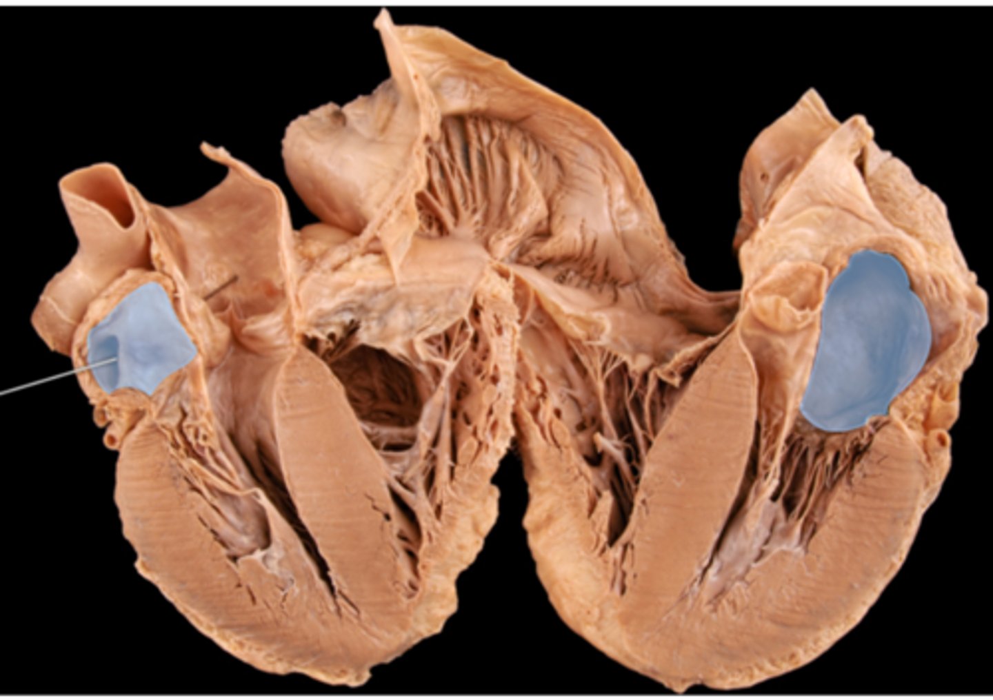 <p>left atrium</p>
