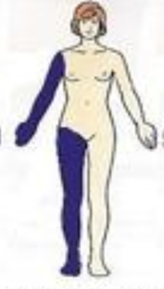 <p>Structures found on the same side of the body</p><p>Ex) Right arm is ipsilateral to the right leg</p>
